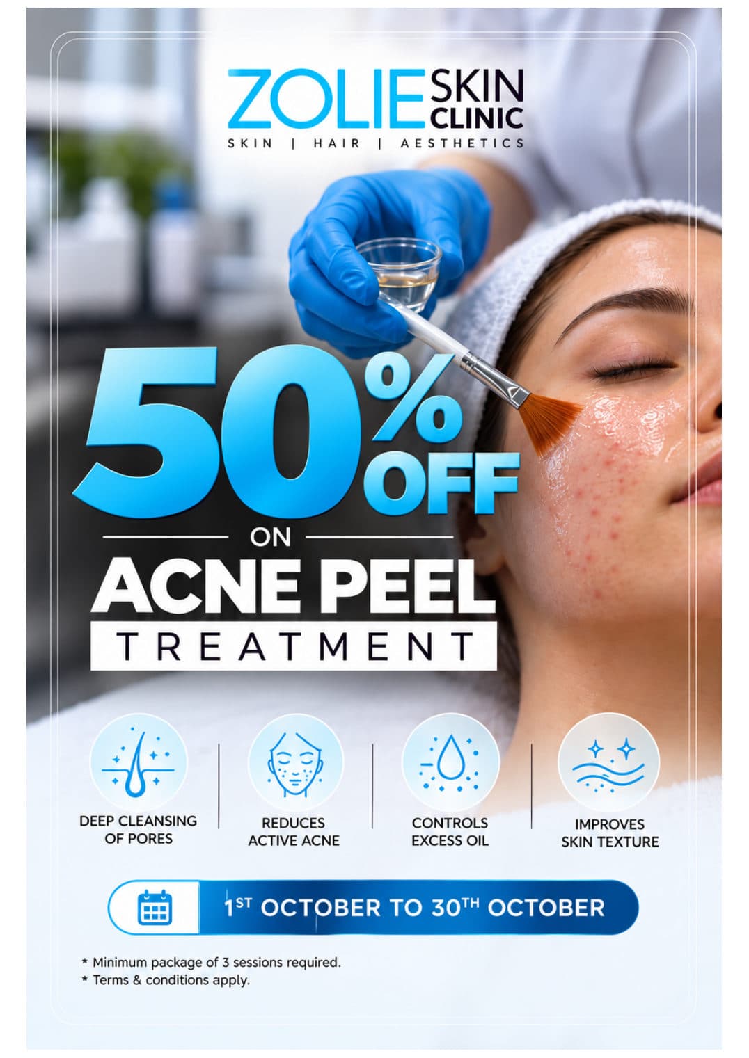 50% off on Acne Peel Treatment at Zolie Skin Clinic