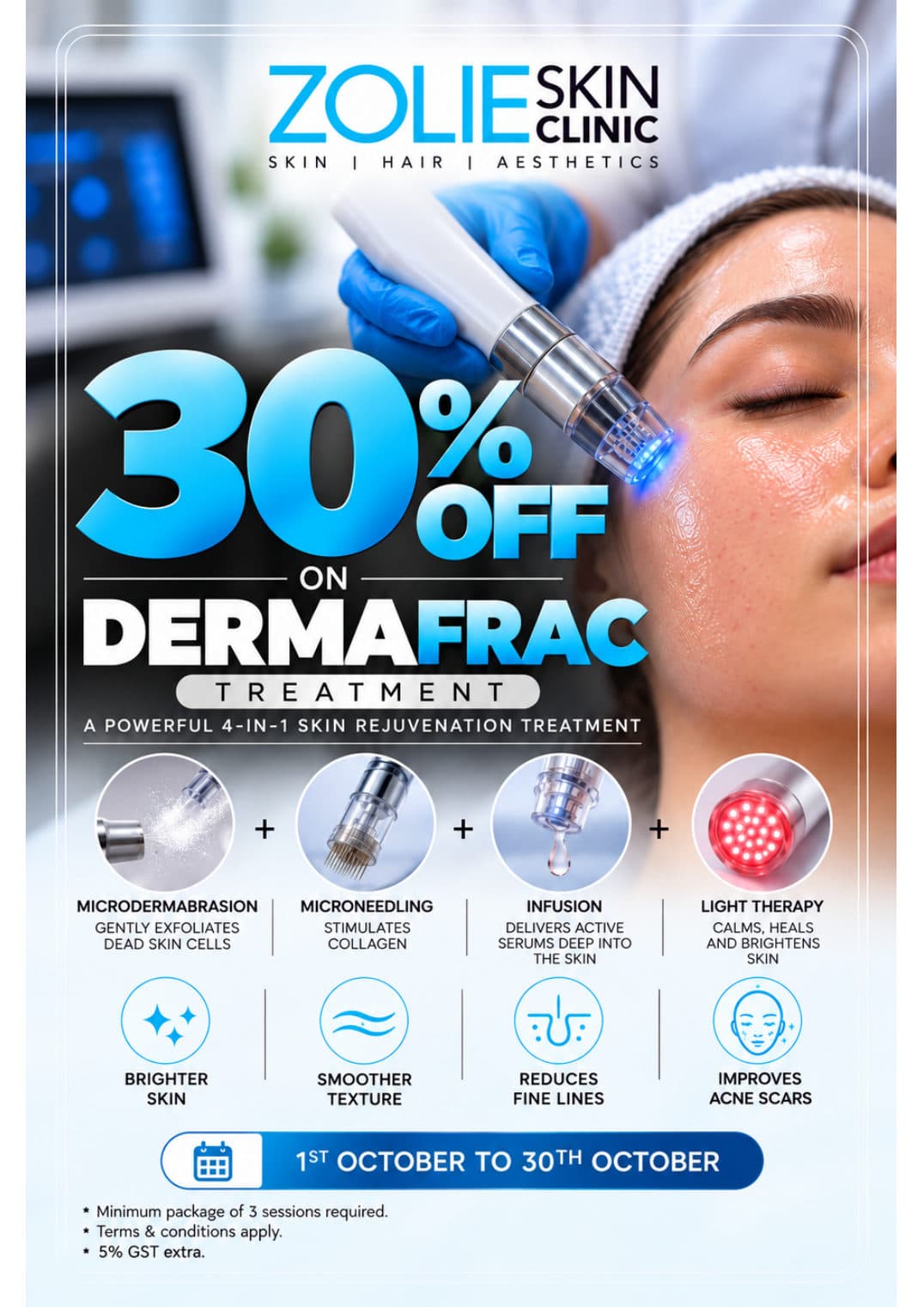 30% off on Dermafrac 4-in-1 skin rejuvenation treatment