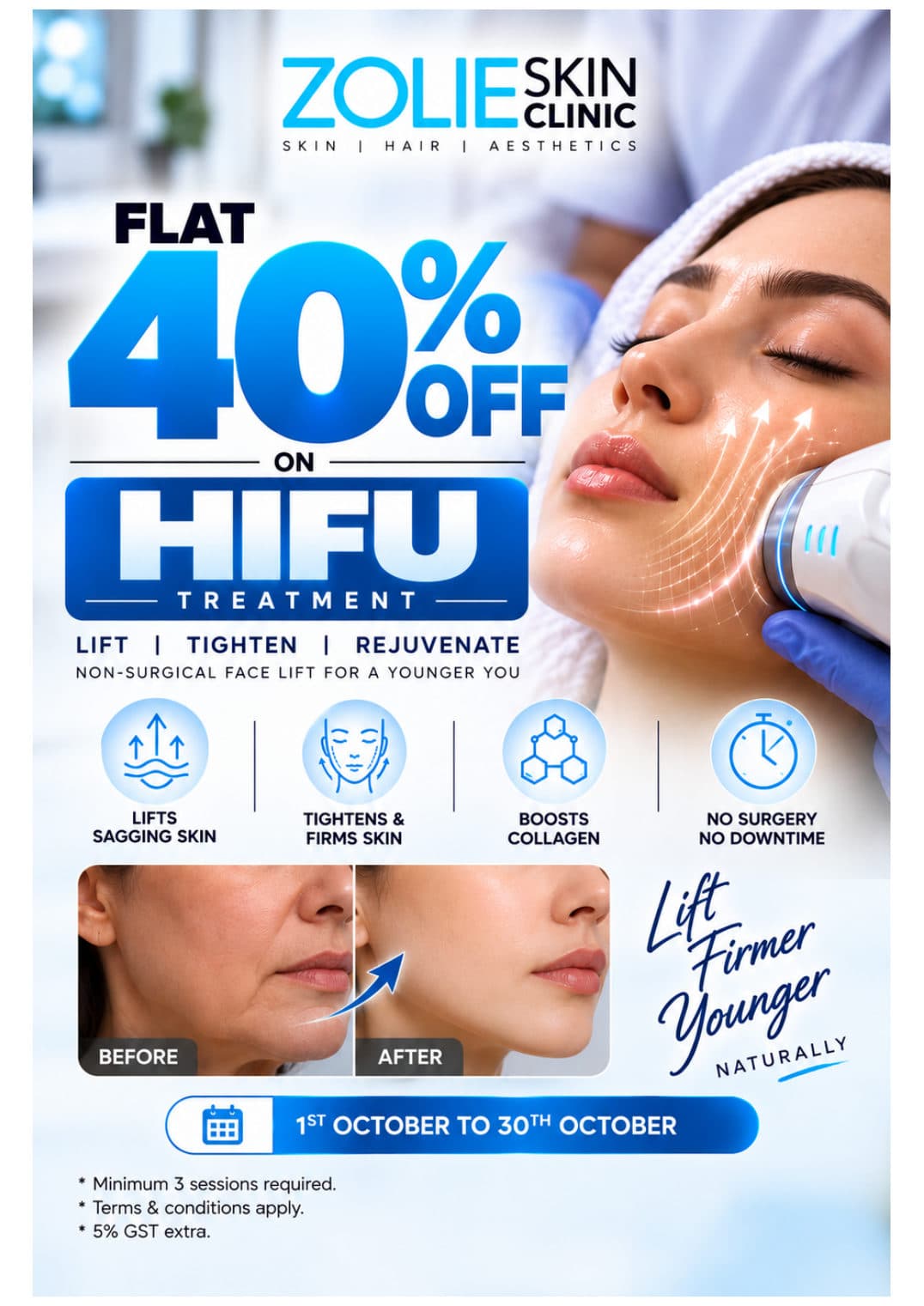Flat 40% off on HIFU non-surgical face lift treatment