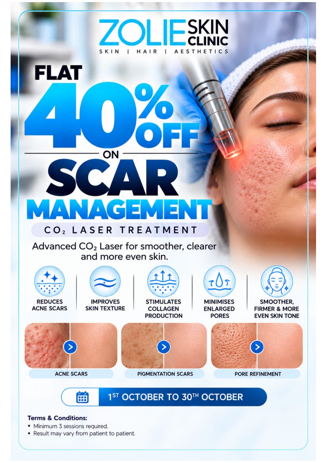 Flat 40% off on Scar Management CO2 Laser Treatment
